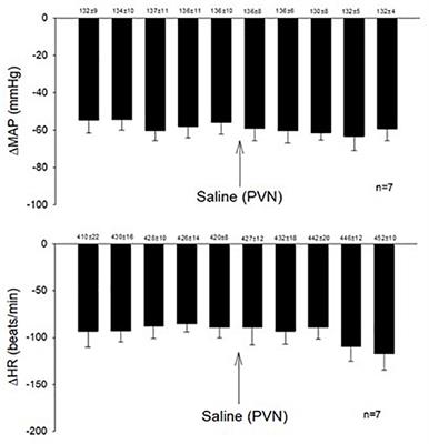 Neurogenic Hypotension and Bradycardia Modulated by Electroacupuncture in Hypothalamic Paraventricular Nucleus